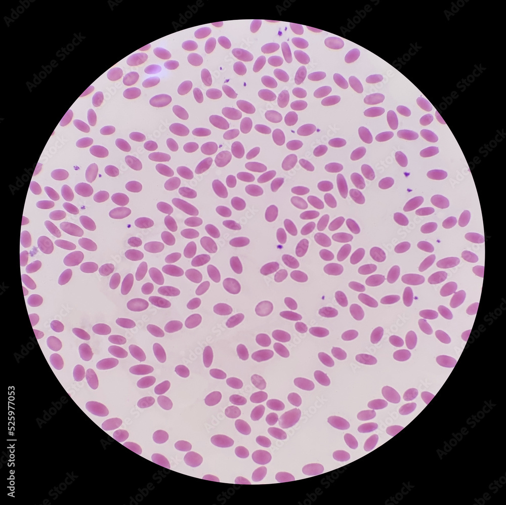 The oval shaped blood cells of the Wild Bactrian Camel. The microscopic image showed erythrocytes, leukocytes and platelet of camel. The oval shaped blood cells of the Wild Bactrian Camel. The microscopic image showed erythrocytes, leukocytes and platelet of camel.