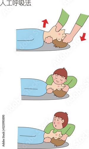 人工呼吸