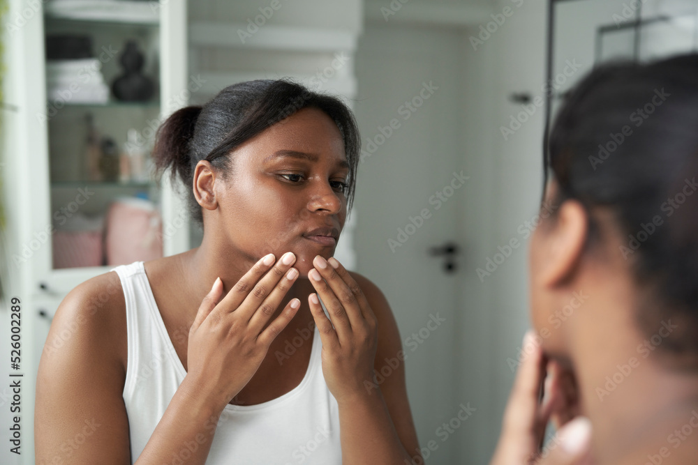 Young African-American woman in the bathroom having acne problems with face. Young African-American woman in the bathroom having acne problems with face.
