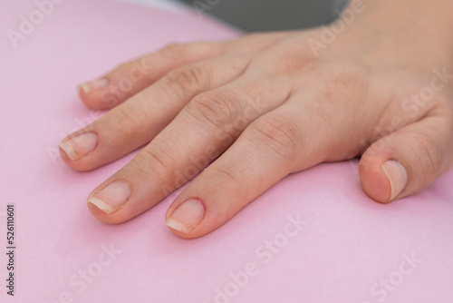 close-up detail of a girl s hand  placed on a pink background  woman s right hand with untidy nails ready to start cleaning and painting in the beauty salon. ready to apply nail polish.