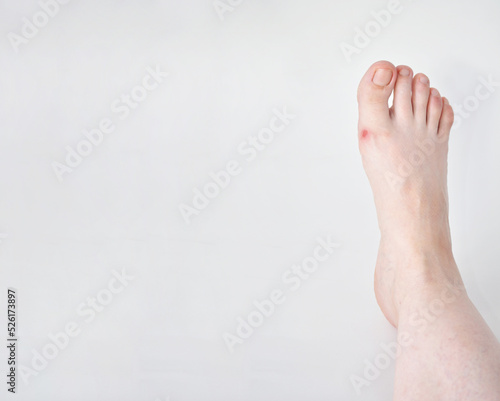 medical background with a bare human leg