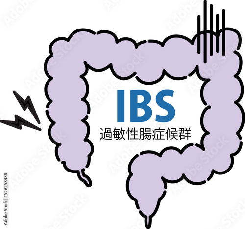 過敏性腸症候群のイラスト