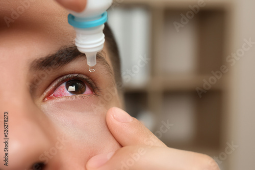Man using eye drops on blurred background, closeup photo