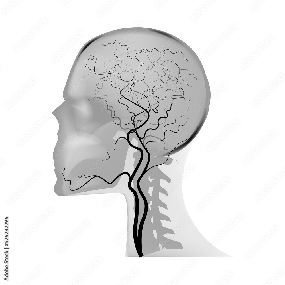 MR angiography of cerebral vessels. Magnetic resonance imaging. Vector illustration MR angiography of cerebral vessels. Magnetic resonance imaging. Vector illustration