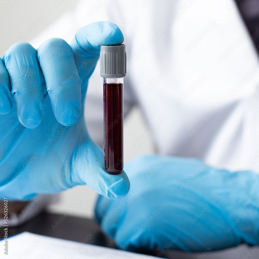 Scientists or doctors collect blood samples from new strains of virus patients for analysis and vaccination in the research laboratory, Vaccine research to eliminate viruses concept. Scientists or doctors collect blood samples from new strains of virus patients for analysis and vaccination in the research laboratory, Vaccine research to eliminate viruses concept.