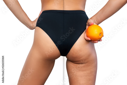 Young woman with cellulite on buttocks and thighs before and after treatment holds orange isolated on white background. Getting rid of excess weight. Result of diet, sports, massage, scrub, wellness