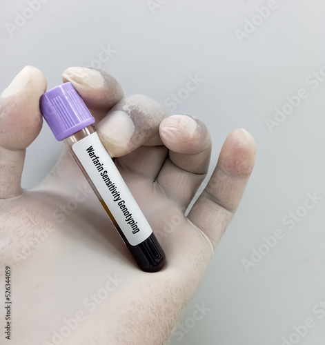Warfarin Sensitivity Genotyping testing in PCR laboratory, to diagnose the tolerance of the drug warfarin. photo