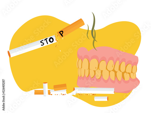 Teeth that are yellow and rotting from cigarettes. Stop smoking.