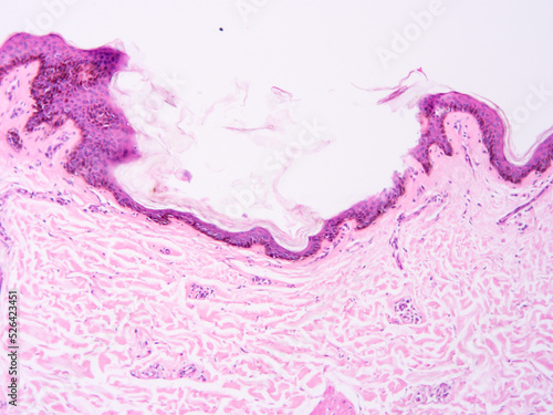 Принти на полотні Histology of human tissue, show  epithelial tissue and connective tissue with mi