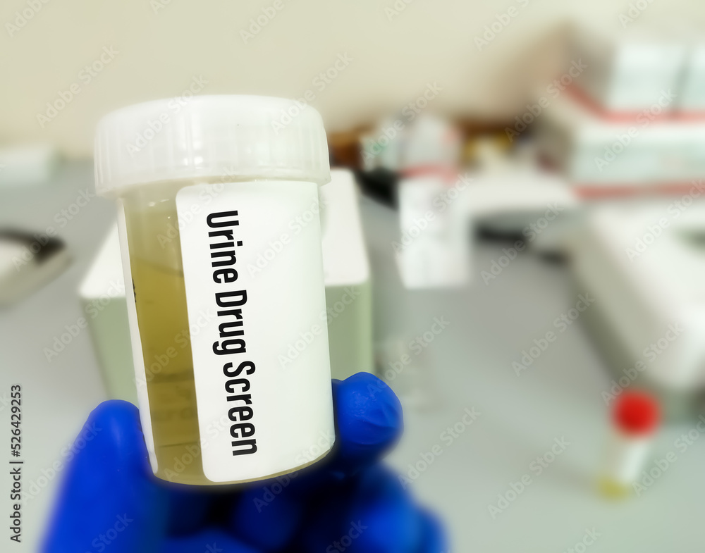 Tab technician holds Urine sample for drug screen test, for the detection of certain illegal drugs in urine.