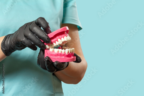 Tableau sur toile Dentist holding the layout of a human jaw