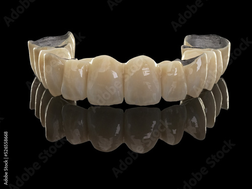 dental metal ceramic bridge on black reflective surface photo