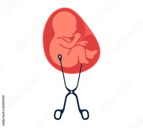 Fetus baby is removed from the womb with gynecological forceps, concept abortion vector illustration