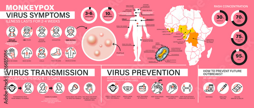 Monkeypox virus symptoms, transmission and prevention. Large detailed infographic with a large number of icons. The spread of the epidemic. Virus epidemic outbreak. Modern flat vector illustration