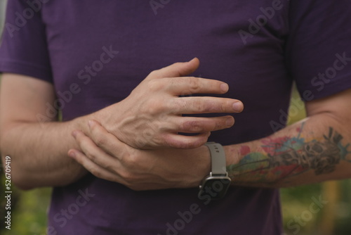 Tablou canvas Man with burn on her hand, closeup