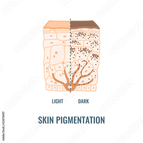 Melanin content and distribution in different skin phototypes. Pigmentation mechanism in dark and light skin. Epidermis cross-section infographic medical diagram. Vector illustration.