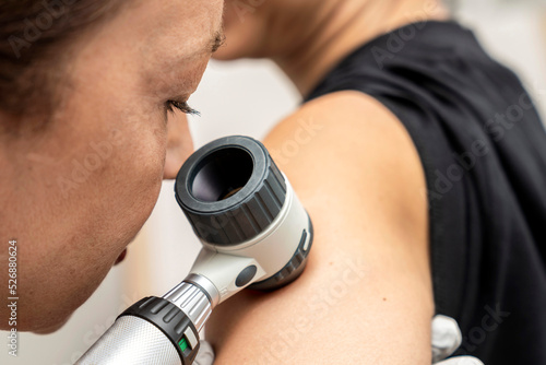 dermatologist examines birthmarks on the patient's skin with a dermatoscope. Dermatology, skin mole examining. looking for signs of melonoma or skin cancer. photo