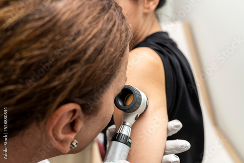 dermatologist examines birthmarks on the patient's skin with a dermatoscope. Dermatology, skin mole exam