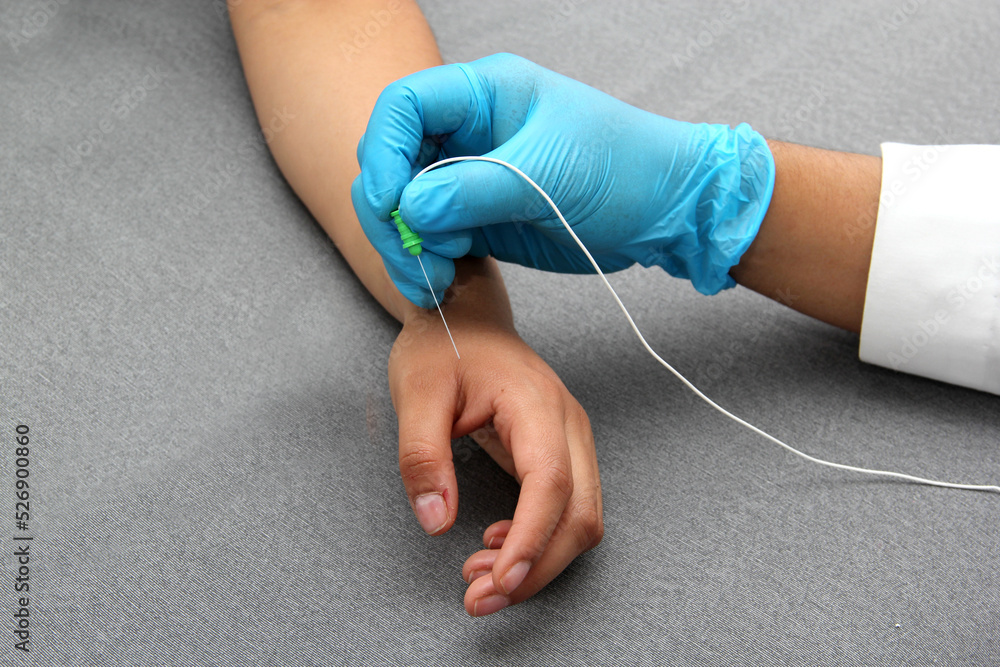 Fotka „Electromyography is a graphic recording technique of the