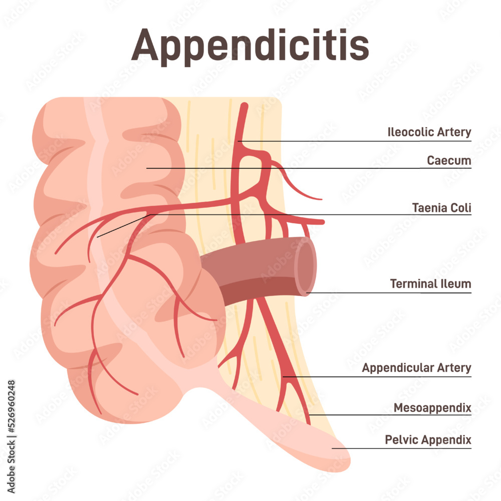Appendix Anatomical Diagram With Large Intestine Caecum And Ileum appendix-anatomical-diagram-with-large-intestine-caecum-and-ileum