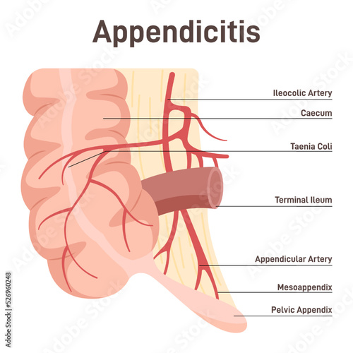 Appendix. Anatomical diagram with large intestine, caecum and ileum. photo