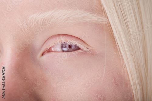 Close-up of young face of albino girl with blue eyes and white eyelashes photo