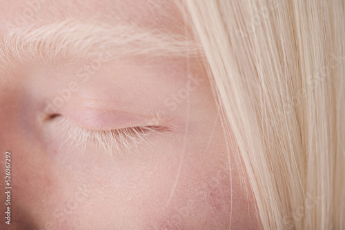 Close-up of albino girl having natural beauty with white eyebrows and eyelashes photo