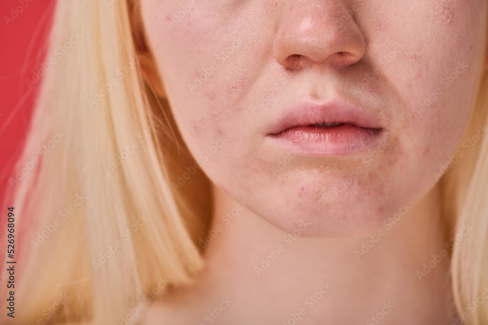Fototapeta premium Close-up of female face with clean skin and white hair