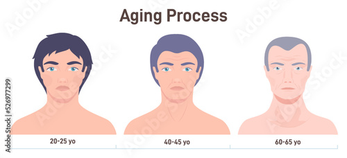 Aging process. Face skin changes, man getting wrinkles with age.
