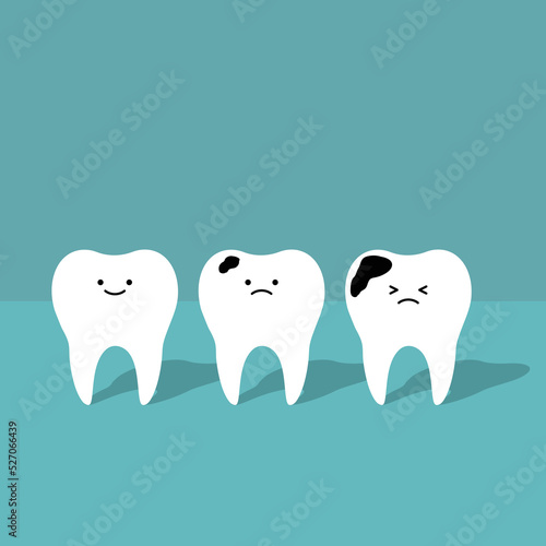 Cute tooth characters with caries cavities. Kawaii smiling faces. Kids dental hygiene health routine good habits concept