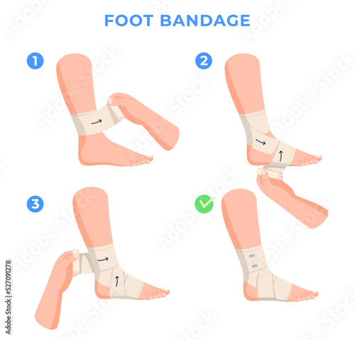 Limb bandaging step-by-step instructions. Help with leg injuries. Bandaging a human leg. Vector illustration