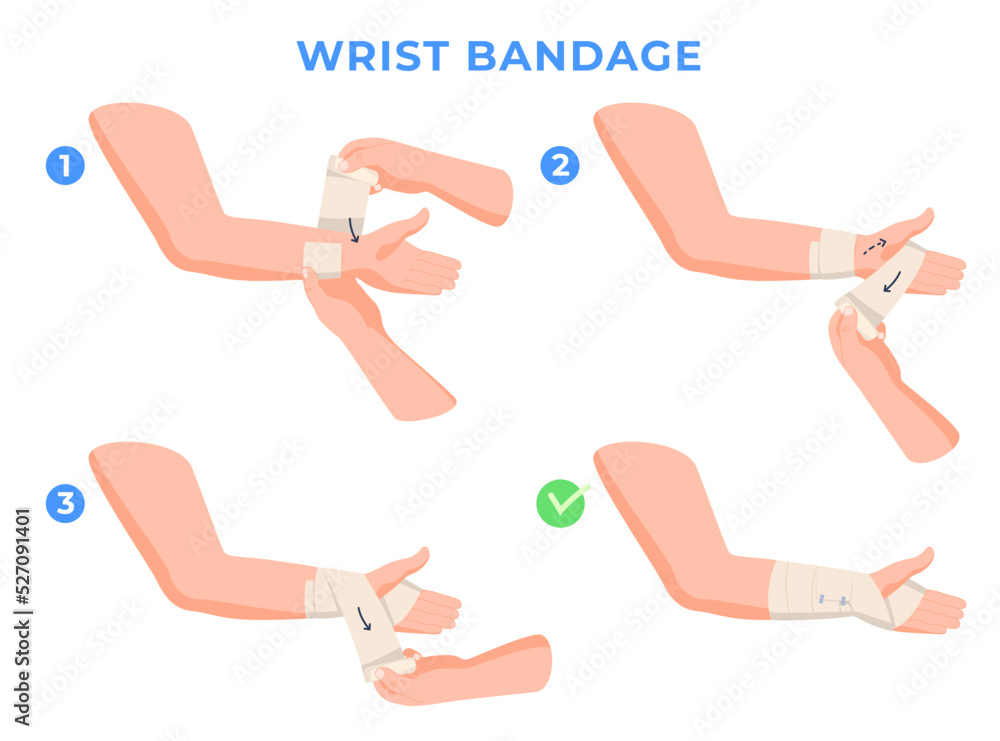 Limb bandaging step-by-step instructions. Help with hand injuries. Bandage of a person hand. Vector illustration Limb bandaging step-by-step instructions. Help with hand injuries. Bandage of a person hand. Vector illustration