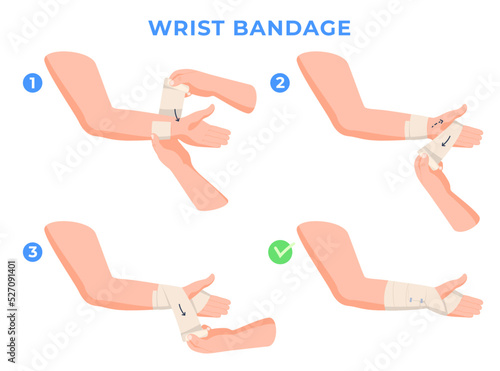 Limb bandaging step-by-step instructions. Help with hand injuries. Bandage of a person hand. Vector illustration