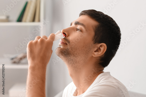 Young man wiping nosebleed with tissue at home, closeup photo