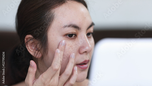 Photography Young Asian woman is lightly touching her cheeks using skin care cosmetics treatment while worry with freckle on face
