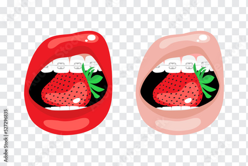 Sexy female lips of red and beige colors with teeth and braces are holding strawberry. Set of prints, vector isolated illustrations on a transparent background