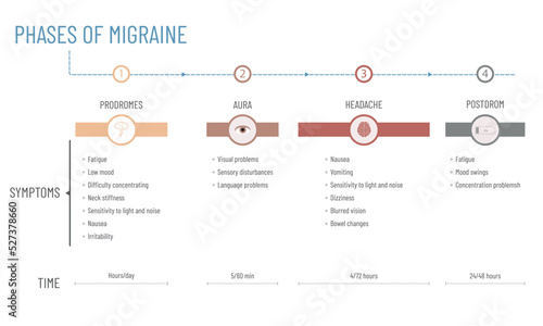 Infographic about the stages of a migraine: duration of each stage and symptoms in each phase.
