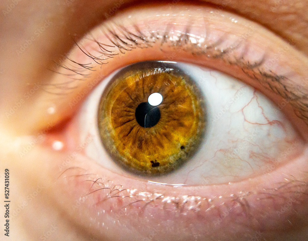 Close Up Of Female Eye, Colored Iris Useful For Ophthalmology Or
