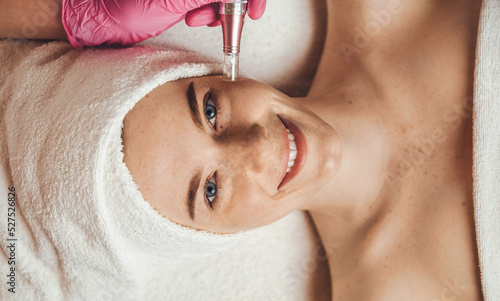 Top view portrait of female face looking at camera getting microdermabrasion procedure in a beauty spa salon. Dermatology, cosmetology. Health care, beauty photo