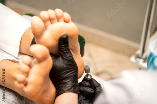 Podiatrist wearing black protective gloves cleaning the skin of foot from callus and corn with the professional electric tool © okskukuruza