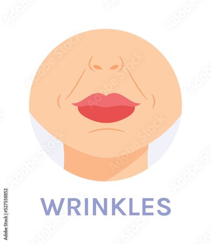 Nasolabial Facial Wrinkles. Skin Problem. Marionette Wrinkles Near the Lips. Female Nose Chin and Neck. Color Cartoon Fashion style. White background. Vector image for Beauty and Cosmetic Design.