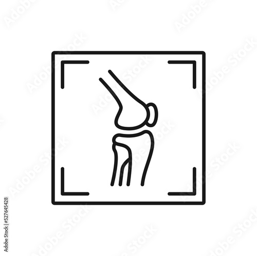 Arthritis knee joint mri scan isolated outline icon. Vector skeleton x ray mri scan of arthritis, injury and erosion on ct or tomography computed imaging