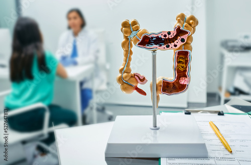 Gastroenterology consultation. Anatomical intestines model on doctor table over background gastroenterologist consulting female patient at medical clinic photo