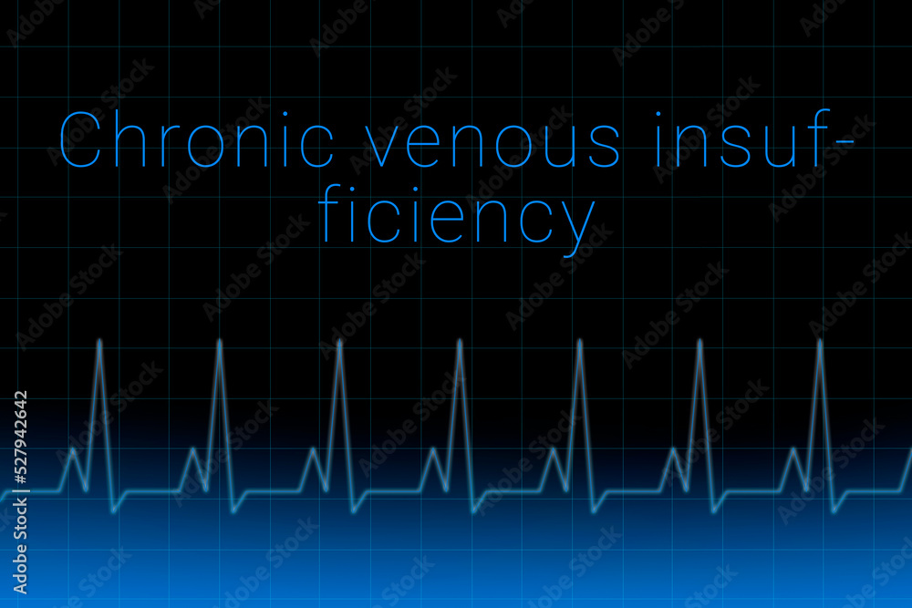 Chronic Venous Insufficiency Disease Chronic Venous Insufficiency Logo chronic-venous-insufficiency-disease-chronic-venous-insufficiency-logo