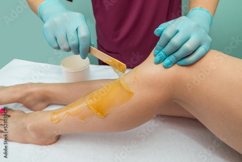 Woman undergoing leg hair removal procedure with sugaring paste in salon