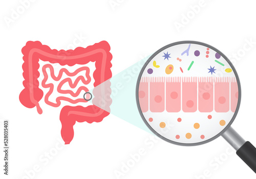 Human microbiome and intestine anatomical poster. Microbiota and surface area of intestinal walls. Intestinal villi and epithelial cells. Digestive system medical vector illustration in human body.