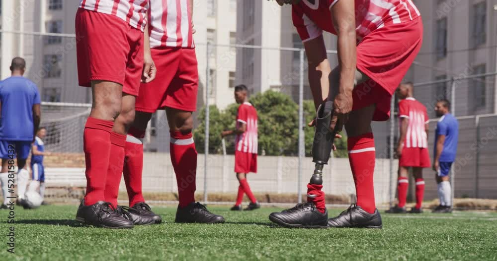 Soccer player remove its prosthetic leg Soccer player remove its prosthetic leg