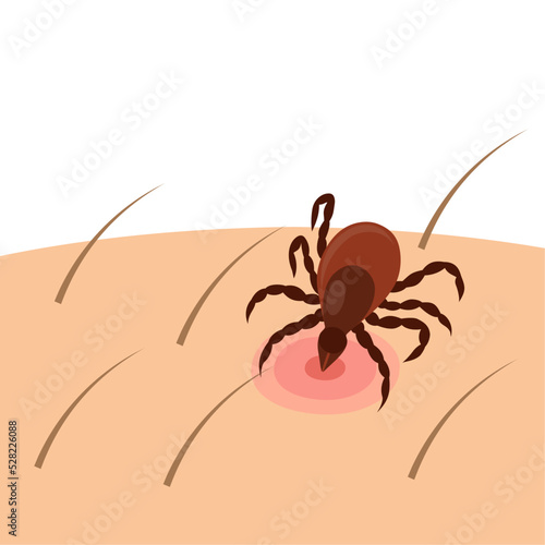 Vector illustration, a tick scientific name Ixodes ricinus, a dangerous insect, isolated on white background.