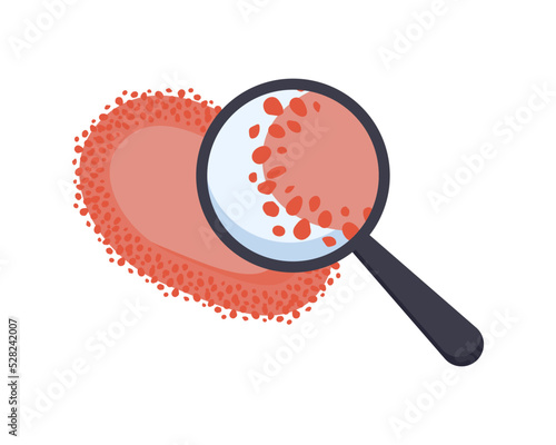 Monkeypox and magnifying glass. Microbiology concept.