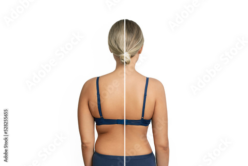 Young woman with excess fat on her back and arms and toned back before and after losing weight isolated on a white background. Result of diet, liposuction, training, healthy lifestyle photo